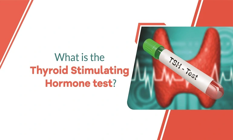 What is the Thyroid Stimulating Hormone Test?